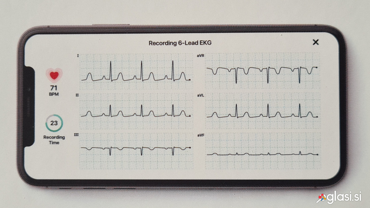 KardiaMobile 6L osebni EKG